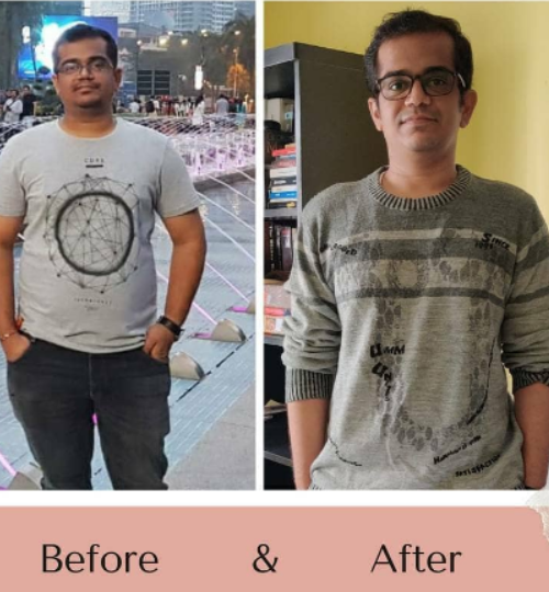 Before After