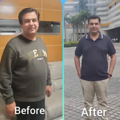 Before After