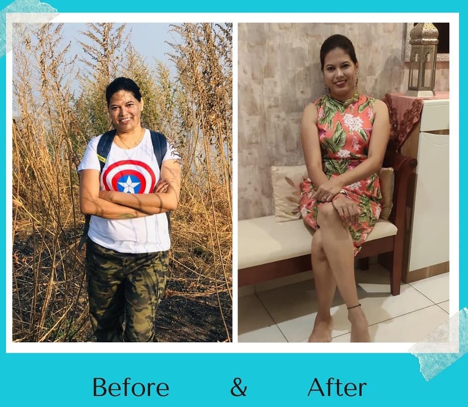 Before After